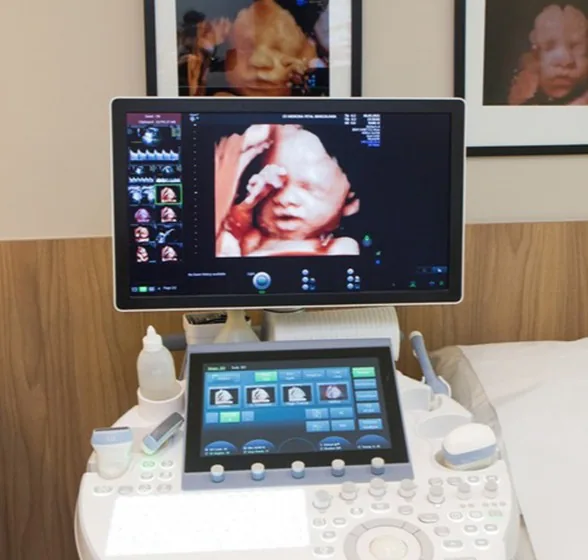 Ultrasound equipment – CR Medicina Fetal